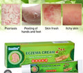 Sumifun Eczema Cream (Herbal Antibacterial Cream)