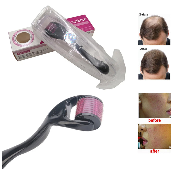 Derma Roller 540 Titanium Needles